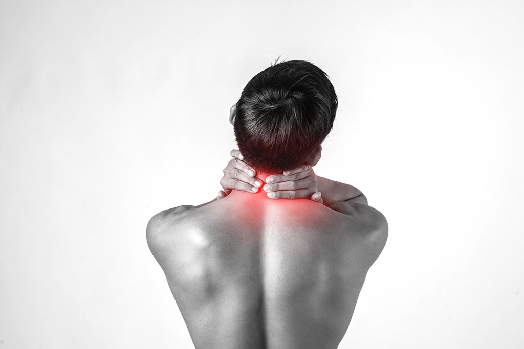 cervicalgia