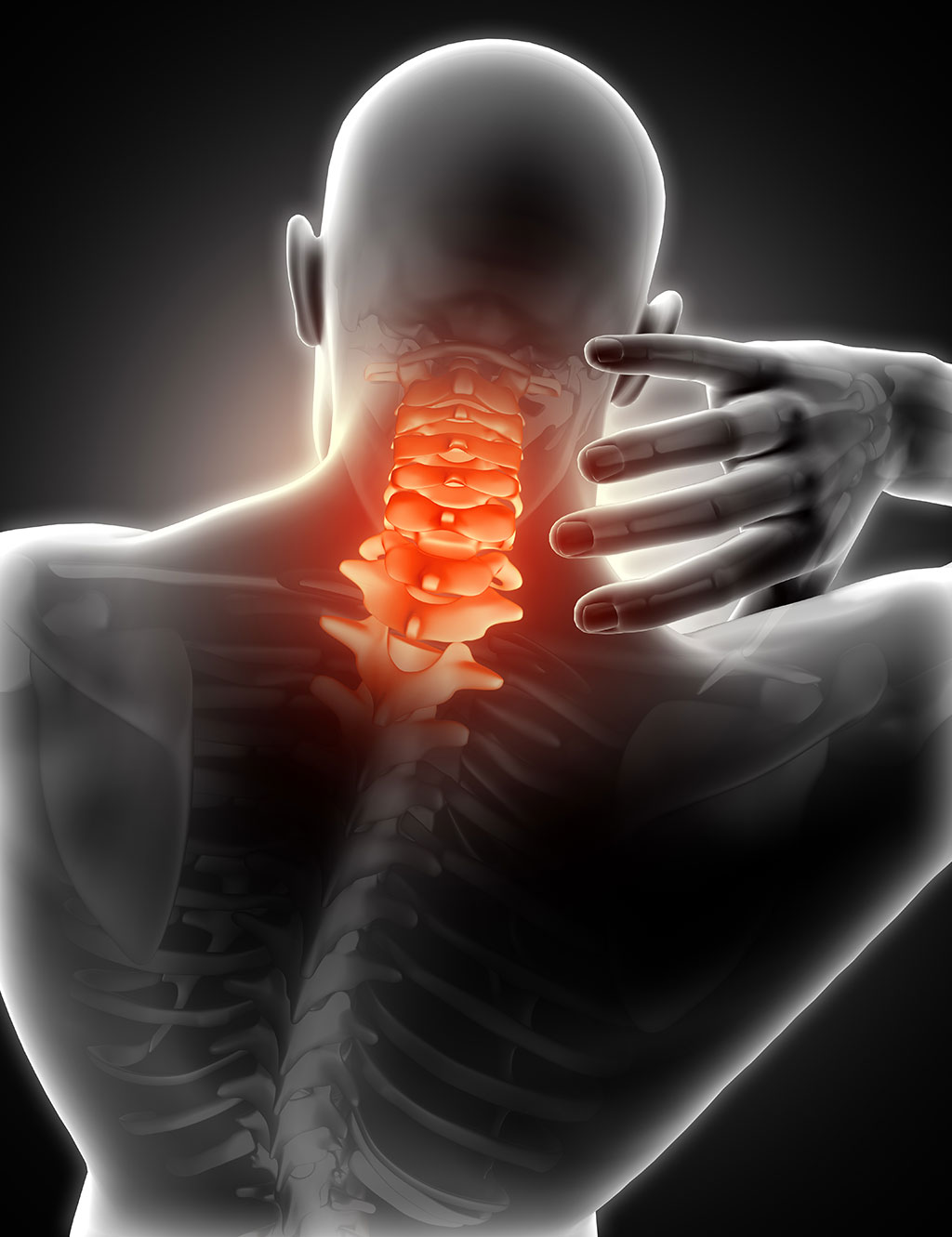cervicalgia
