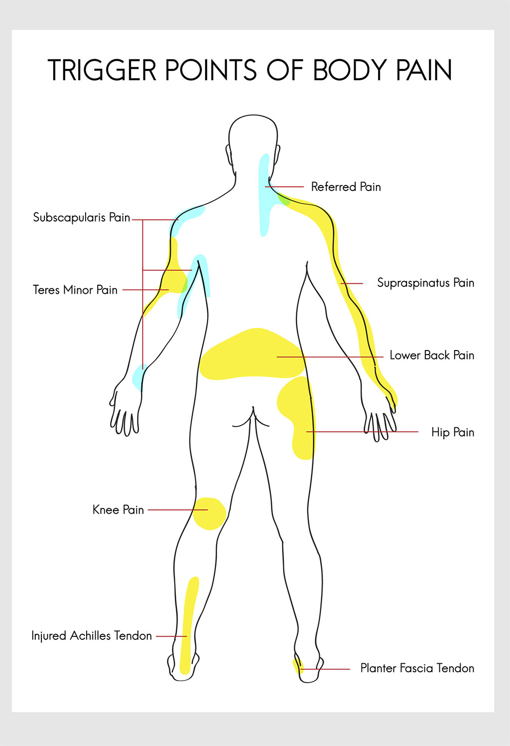 Trigger Point