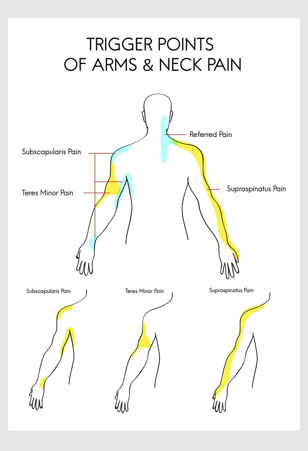 Trigger Point