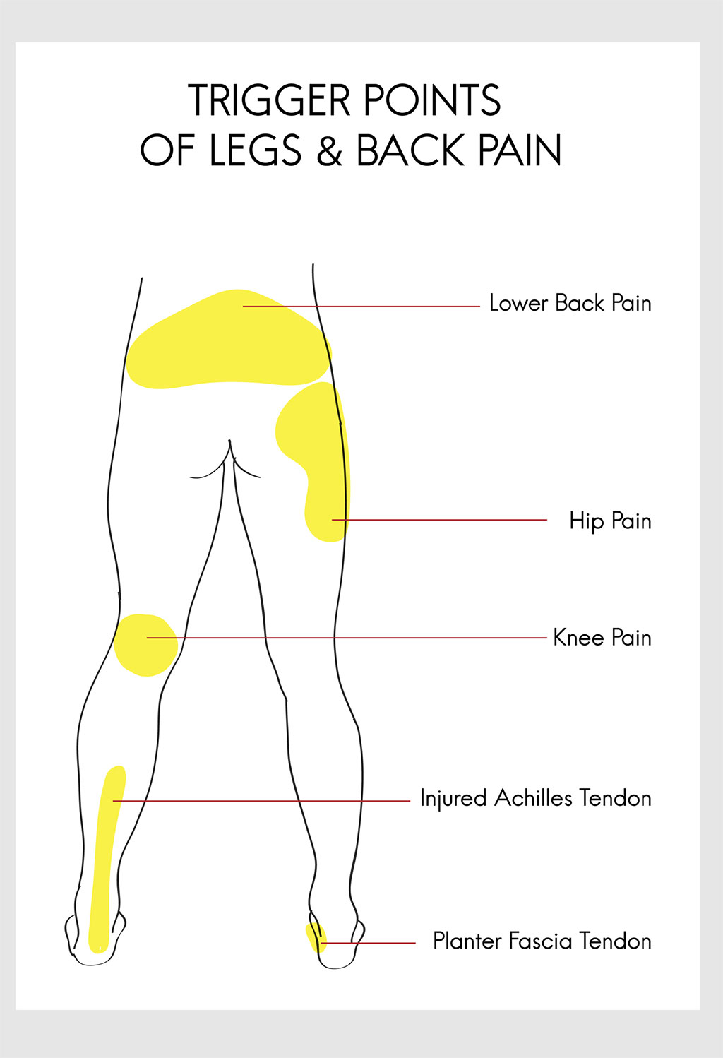 Trigger Point